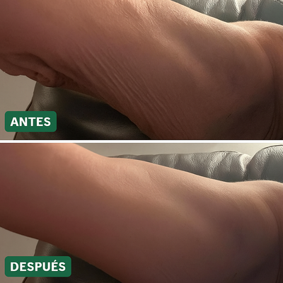 Tratamiento Reparador De Piel