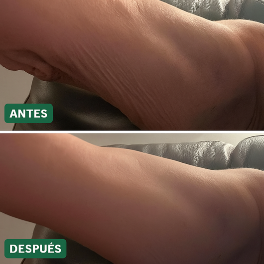 Tratamiento Reparador De Piel